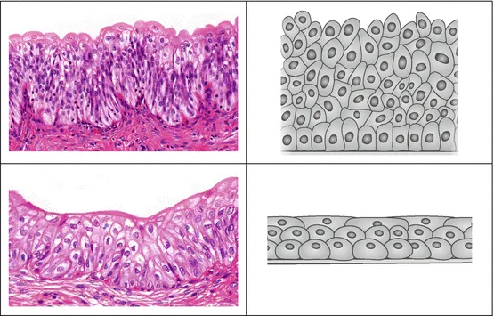 Urothelium: Relaxed vs. Distended Histology and Diagram