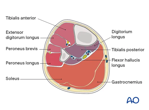 Leg cross-section: fascial compartments & neurovasculature