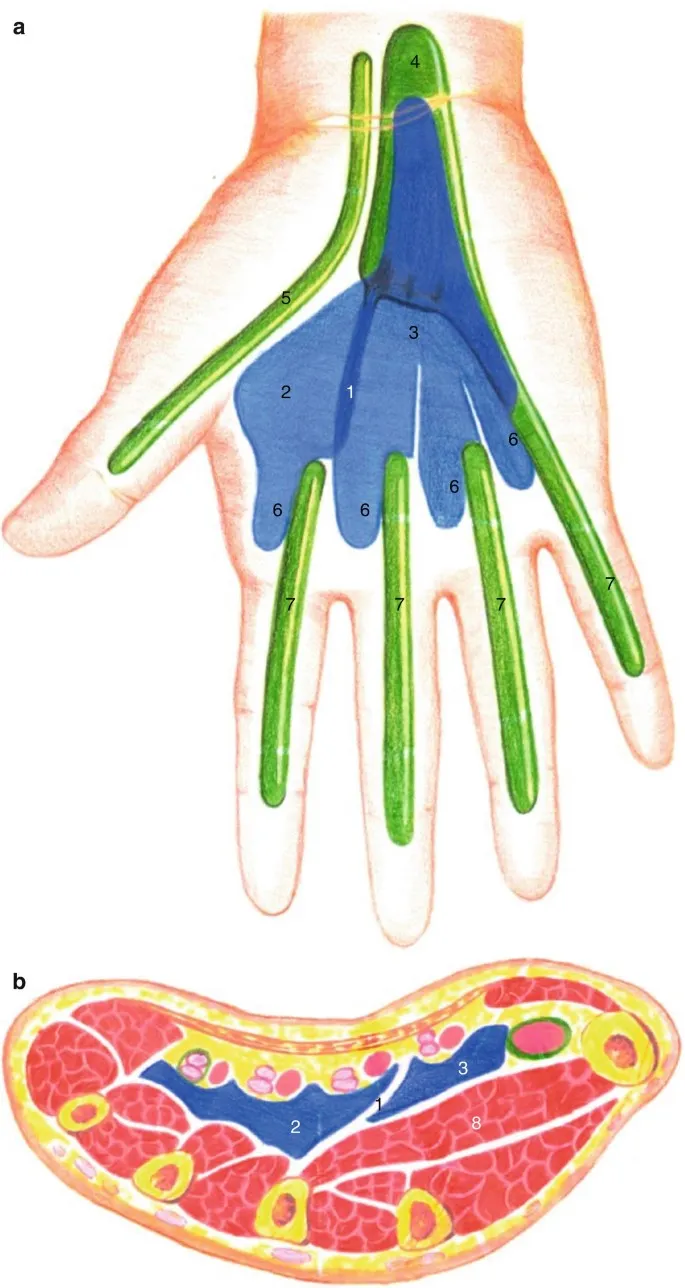 Hand Fascial Spaces & Synovial Sheaths