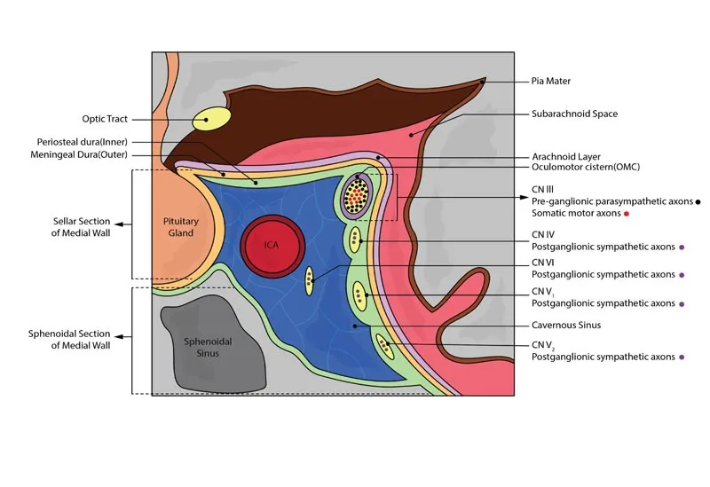 Coronal view of Cavernous Sinus and contents