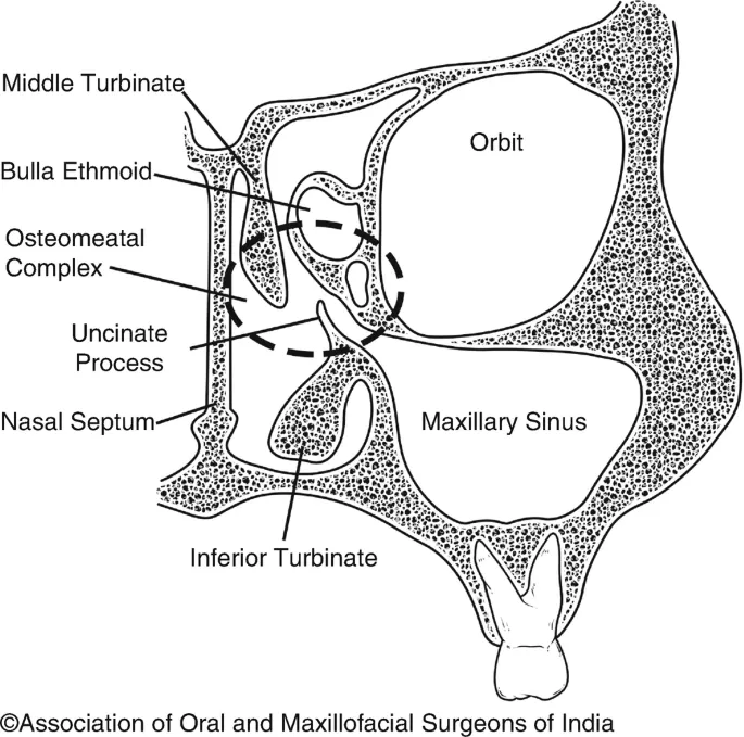 Coronal view of paranasal sinuses and osteomeatal complex