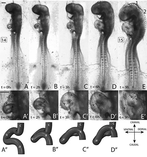 Embryonic heart tube development and looping