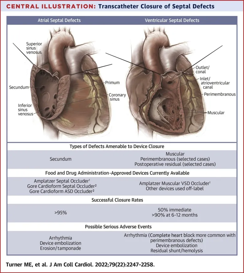 Anatomy of Atrial and Ventricular Septal Defects
