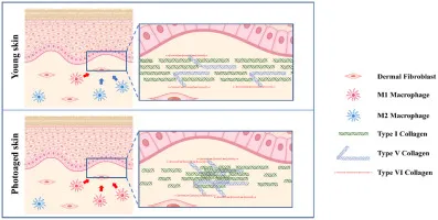 Young vs. Photoaged Skin: Collagen & Macrophage Changes