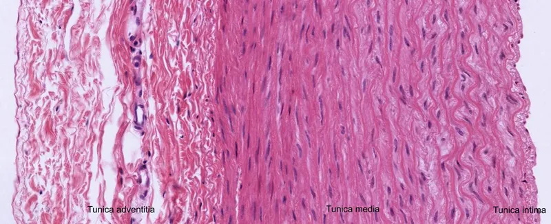 Aorta Histology: Tunica Intima, Media, Adventitia
