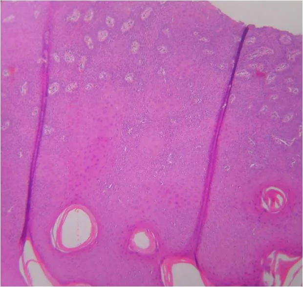 Histology artifacts: knife marks and shrinkage