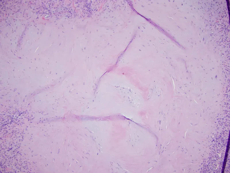 H&E stain of fibrous tissue with basophilic nuclei