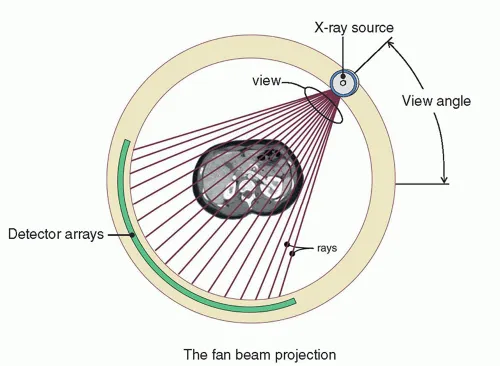 CT Fan Beam Projection Diagram