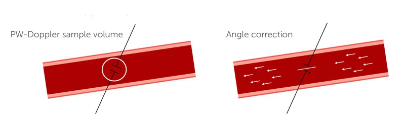 PW-Doppler sample volume and angle correction