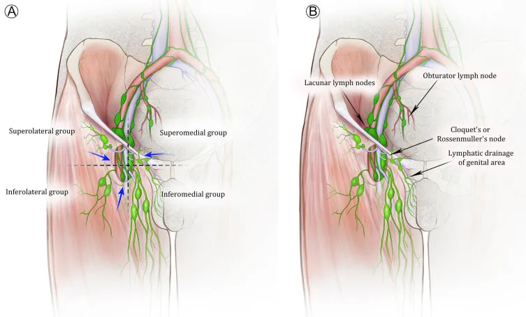 Superficial inguinal lymph node drainage