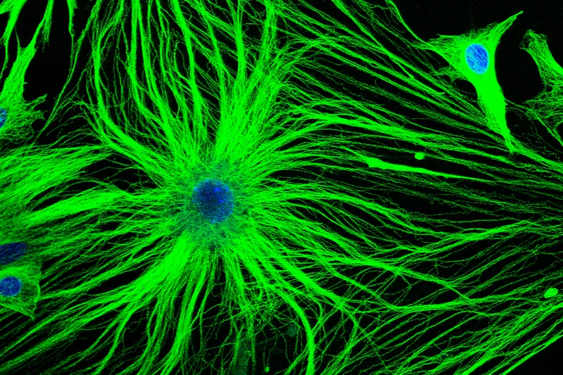 Microscopic view of astrocytes