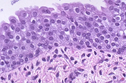Histology of transitional epithelium (urothelium)