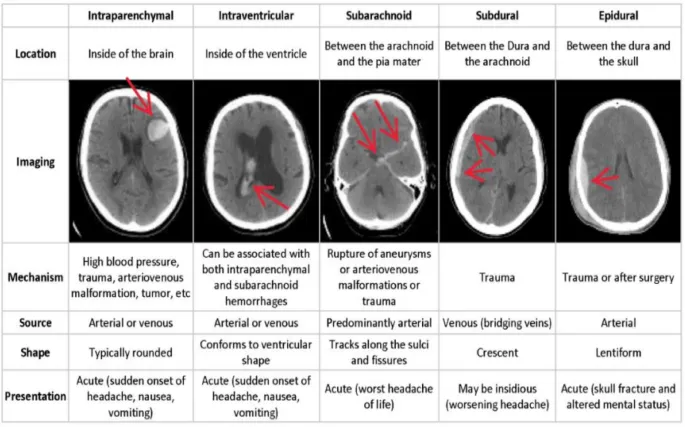 CT Scan Comparison of Intracranial Hemorrhages
