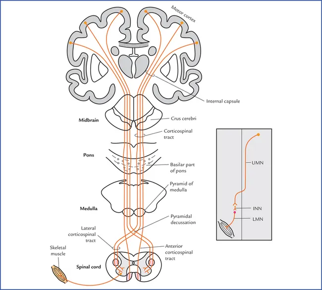Corticospinal Tract Pathway with UMN and LMN