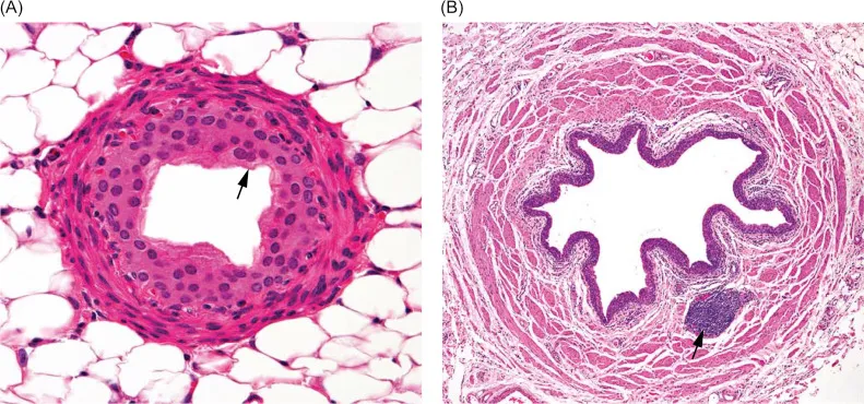 Ureter and Bladder Histology