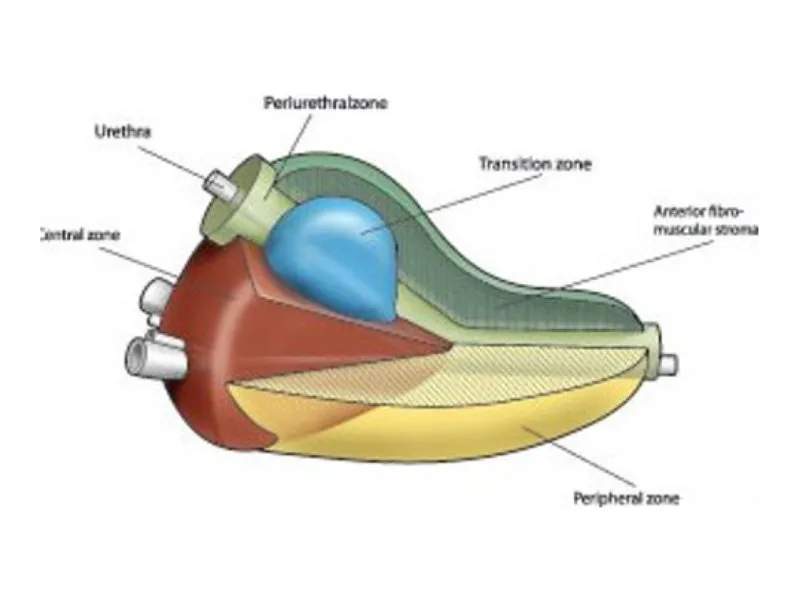 Prostate zonal anatomy and relation to urethra (sagittal)