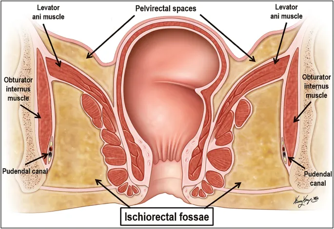 Coronal view of ischiorectal fossae and pudendal canal