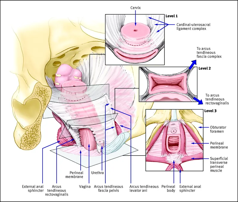 DeLancey's Levels of Pelvic Support