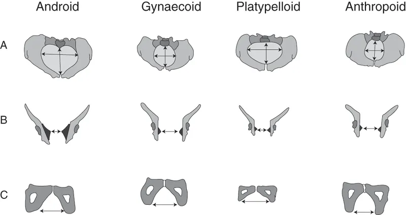 Pelvic types and key obstetric diameters