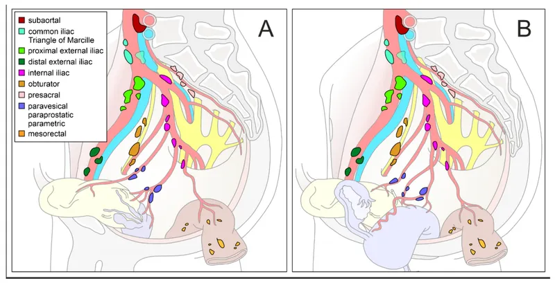 Pelvic Lymph Node Stations Diagram