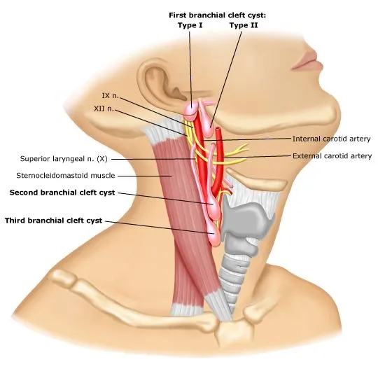 Branchial Cleft Cysts and Associated Anatomy