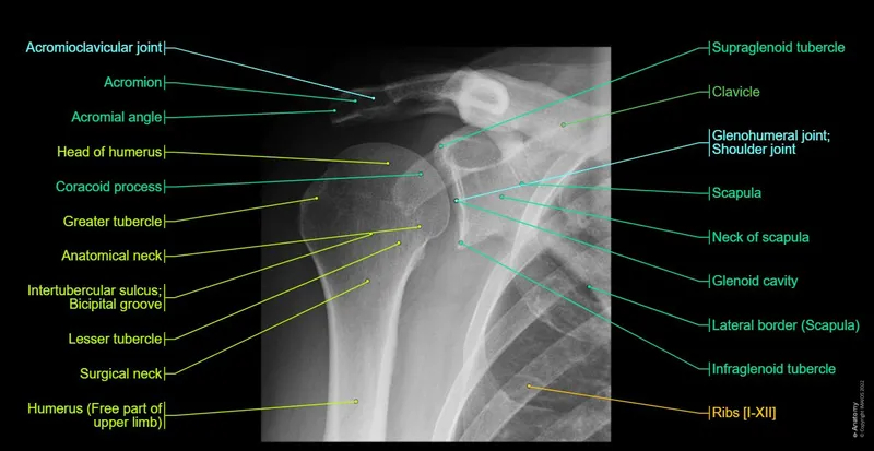 Shoulder X-ray AP view with bony landmarks