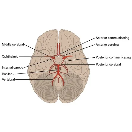 Circle of Willis and major cerebral arteries