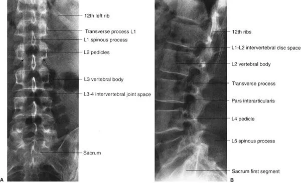 AP and Lateral Lumbosacral Spine X-ray with Labeled Anatomy
