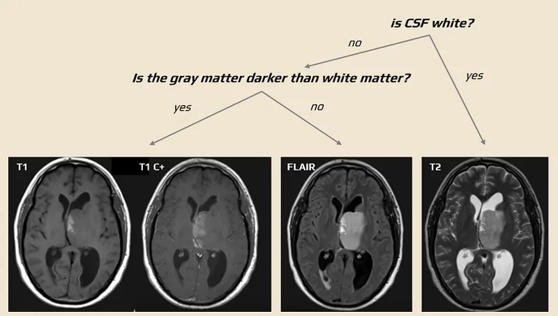 MRI Brain Sequences: T1, T1 C+, FLAIR, T2 Comparison