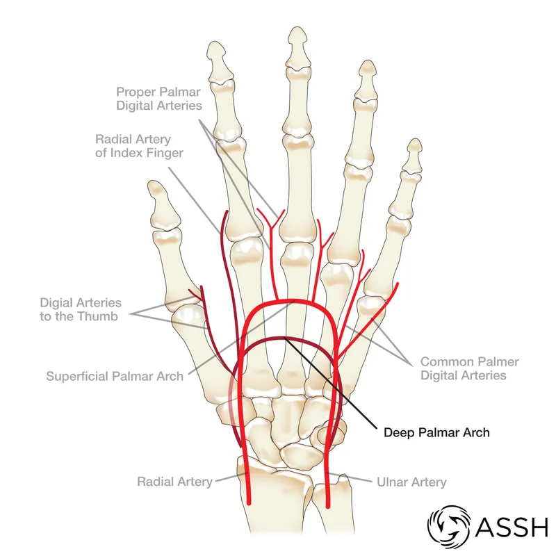 Arterial supply of hand showing palmar arches