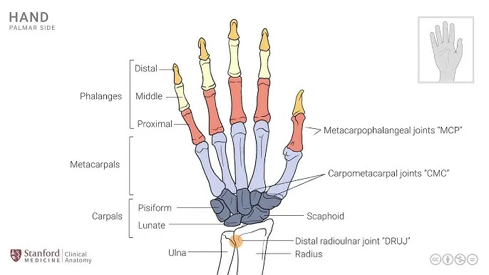 Labeled diagram of hand and wrist joints, palmar view