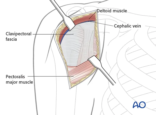 Pectoral region anatomy: muscles, fascia, vein