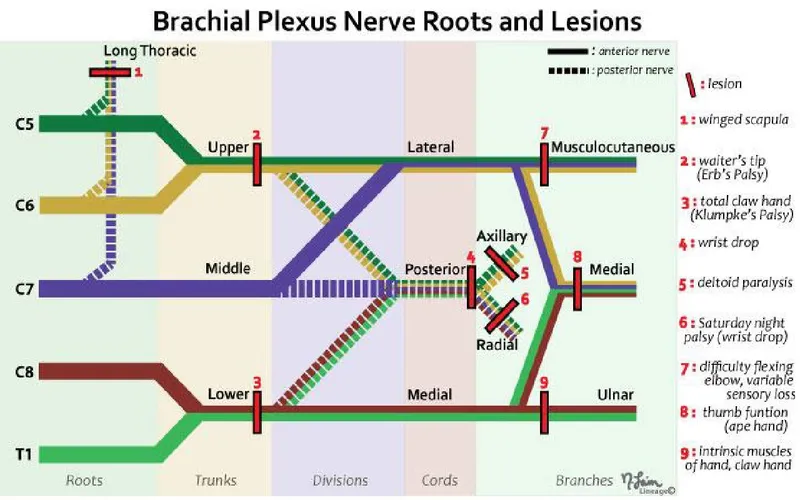 Brachial Plexus Nerve Roots and Lesions