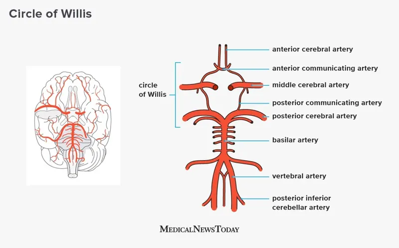 Circle of Willis arterial diagram with brain overlay
