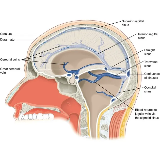 Dural Venous Sinuses and Brain Venous Drainage