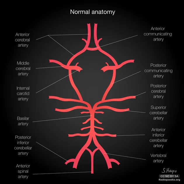 Circle of Willis and Vertebrobasilar System Diagram