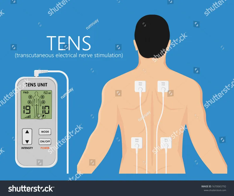 Transcutaneous Electrical Nerve Stimulation (TENS) Unit
