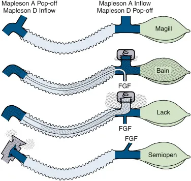 Mapleson A and D Breathing Circuits
