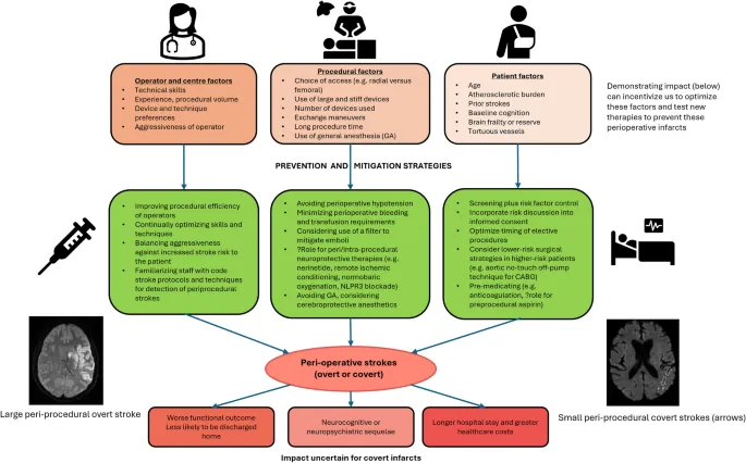 Perioperative Stroke Factors, Prevention, and Outcomes