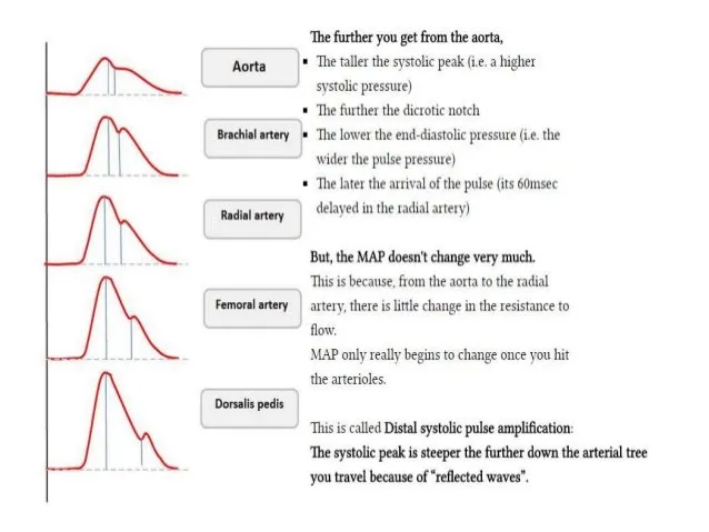 Arterial Line Waveform Changes in Different Arteries
