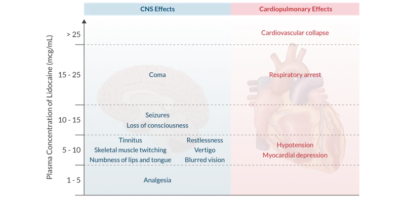 LAST CNS and Cardiopulmonary Toxicity Progression