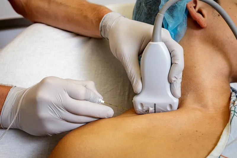 Ultrasound-guided nerve block procedure