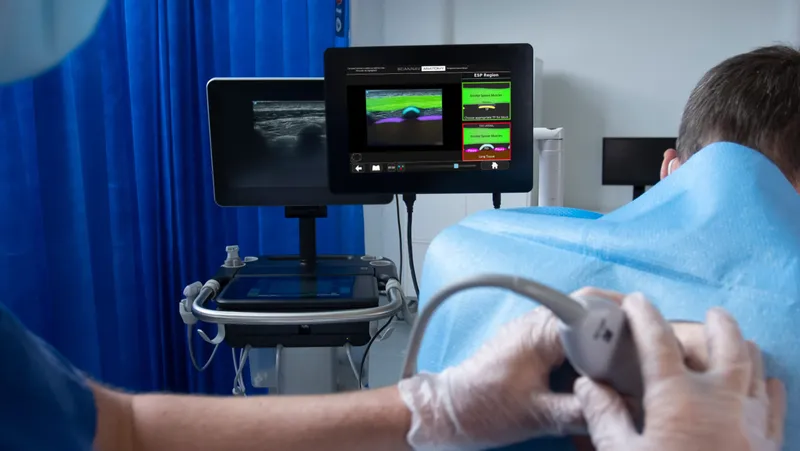 Ultrasound-guided nerve block procedure