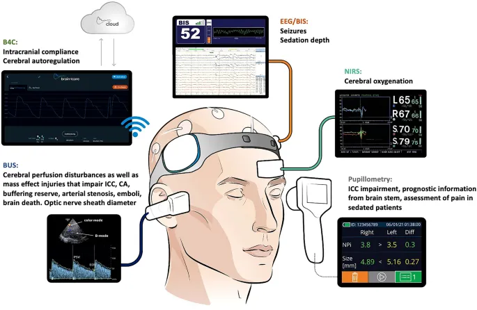 Neuromonitoring for Traumatic Brain Injury