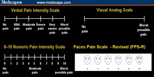 Various Pain Assessment Scales