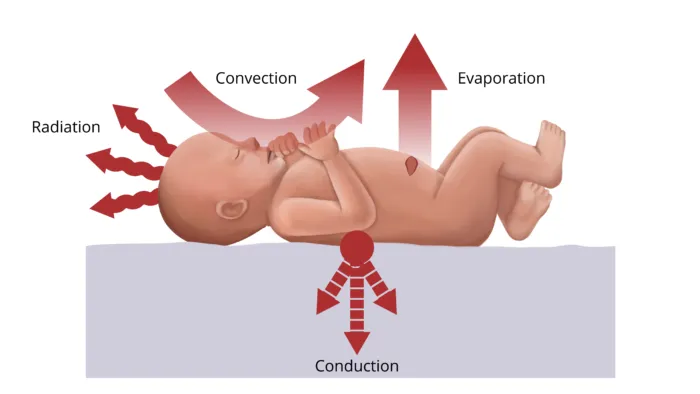 Mechanisms of Heat Loss in Infants