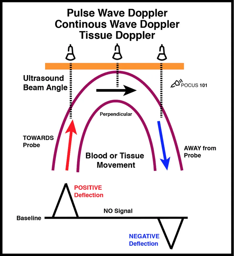 Doppler ultrasound principles: direction of flow