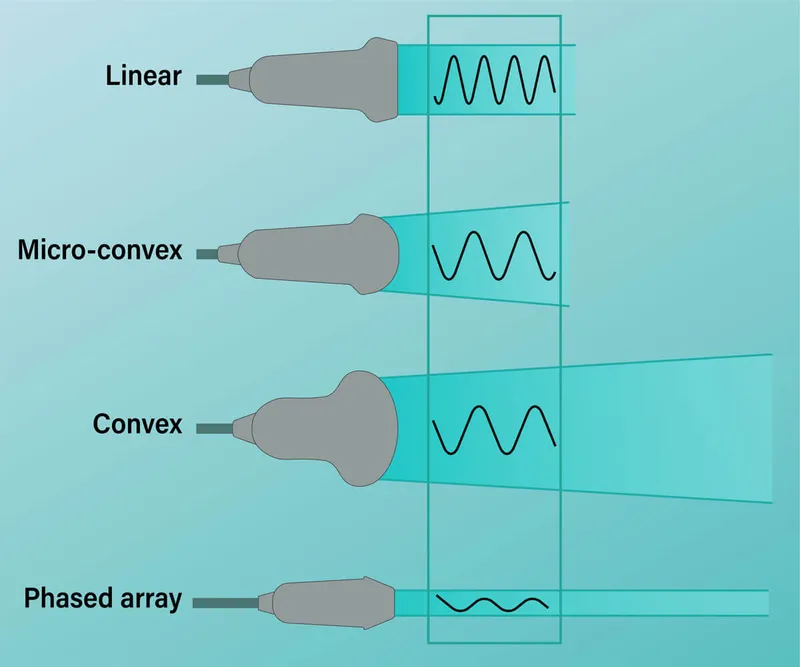 Ultrasound probe types and beam shapes