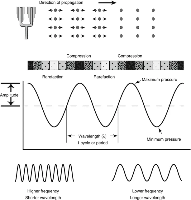 Ultrasound wave parameters