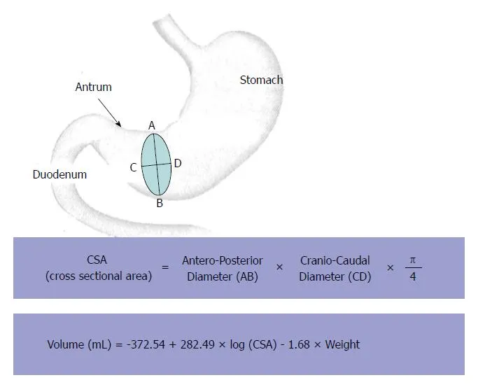 Gastric Antrum CSA and Volume Calculation